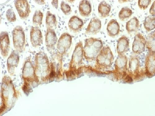 Catenin, beta (p120) Antibody