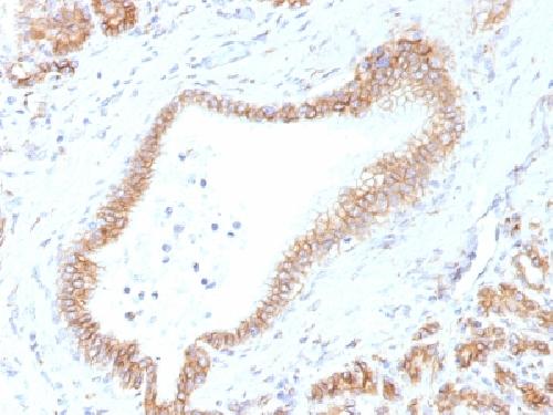 Catenin, beta (p120) Antibody