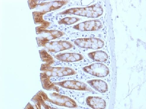Catenin, beta (p120) Antibody