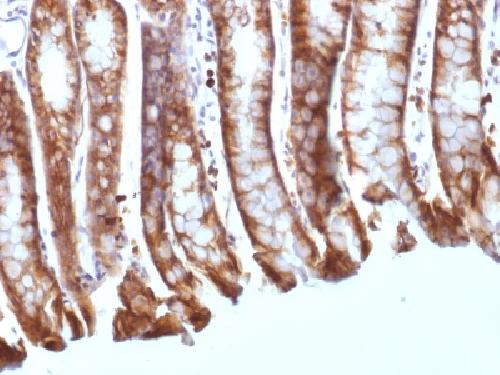 Catenin, beta (p120) Antibody
