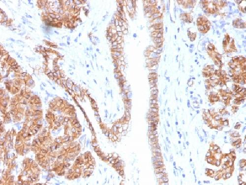 Catenin, beta (p120) Antibody