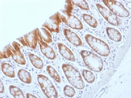 Catenin, beta (p120) Antibody
