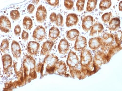 Catenin, beta (p120) Antibody