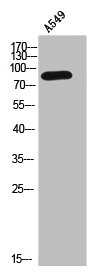 CTNNB1 Antibody