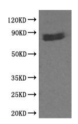 CTNNB1 Antibody