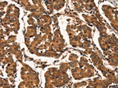 CTNNBIP1 Antibody