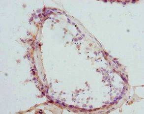 CTNNBL1 Antibody