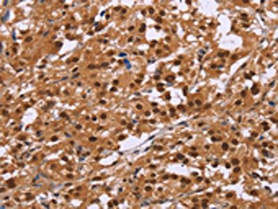 CTNNBL1 antibody