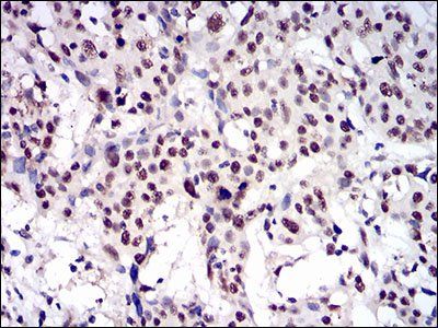 CTNNBL1 Antibody