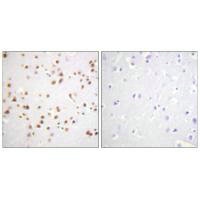 CTNND1 (Ab-228) Antibody