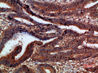 CTNND1 Antibody