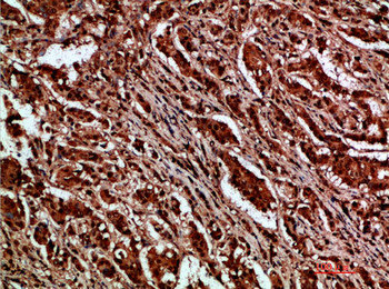 CTNND1 antibody