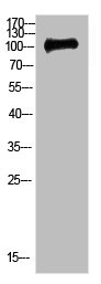 CTNND1 antibody