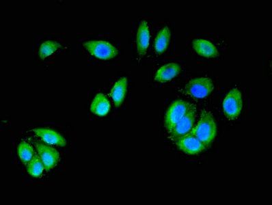CTNND1 Antibody