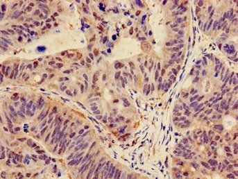 CTNND1 Antibody