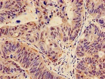 CTNND1 antibody