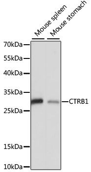 CTRB1 antibody