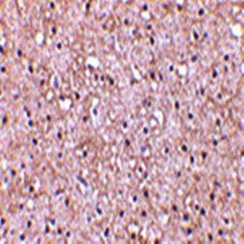 CTRP5 Antibody