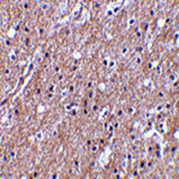 CTRP6 Rabbit Polyclonal Antibody