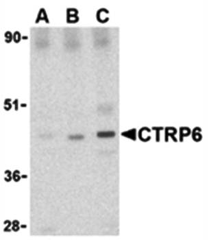 CTRP6 Rabbit Polyclonal Antibody