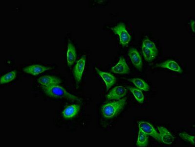 CTSA antibody