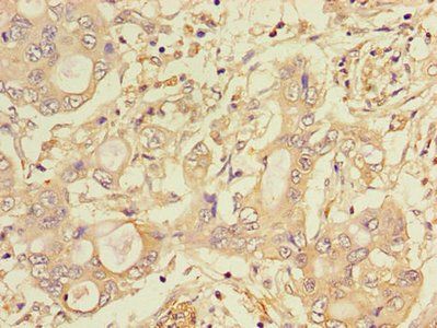 CTSA Antibody