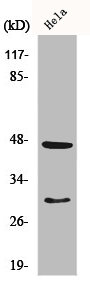CTSD Antibody
