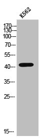 CTSD Antibody