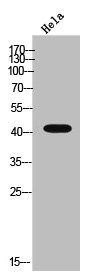 CTSD Antibody