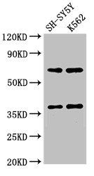 CTSH Antibody