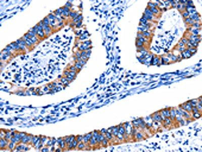 CTSH Antibody