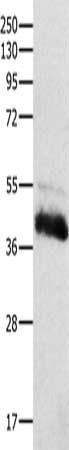 CTSH Antibody