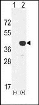 CTSK antibody