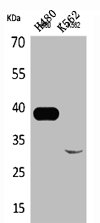 CTSL Antibody