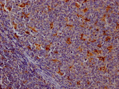 CTSS Recombinant Monoclonal Antibody