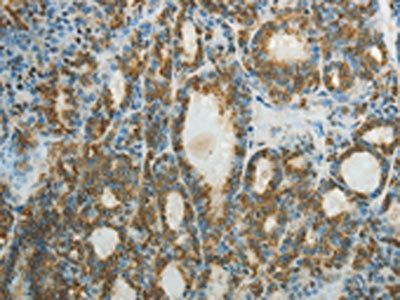 CTSV Antibody