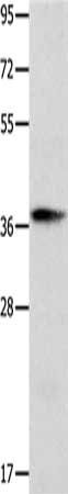 CTSV antibody