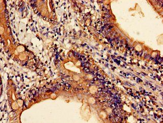 CTSZ Antibody