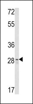 CUEDC2 antibody