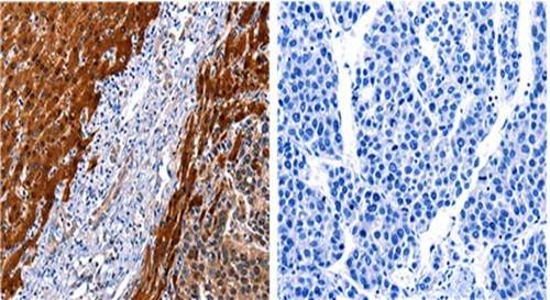 CUL4A Rabbit Polyclonal Antibody