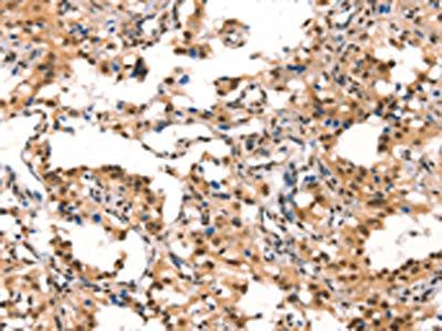 CUL4B Antibody