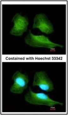 Cullin 7 antibody [C2C3], C-term