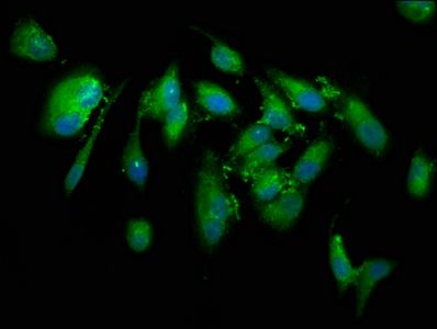 CUTC antibody