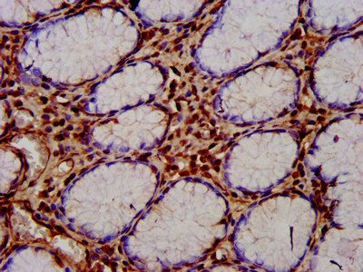CUTC Antibody