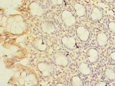 CWF19L1 Antibody
