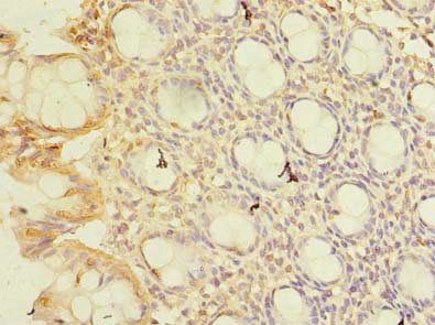 CWF19L1 antibody