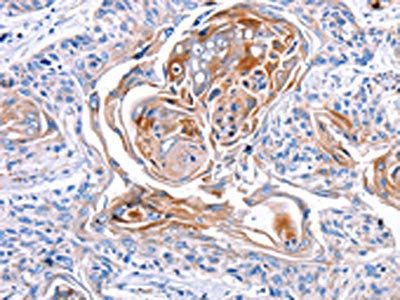 CX3CL1 Antibody