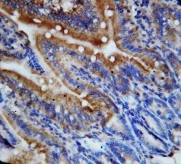 Fractalkine CX3CL1 Antibody