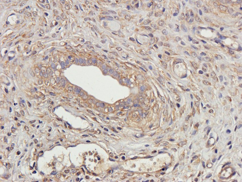 CXCL10 antibody