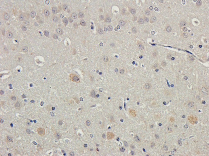 CXCL10 antibody